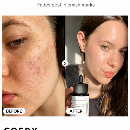 COSRX | The Niacinamide 15 Serum 20ml